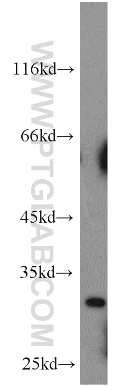 Western Blot (WB) analysis of mouse heart tissue using Mast Cell Chymase Polyclonal antibody (18189-1-AP)