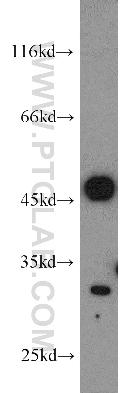 Western Blot (WB) analysis of MCF-7 cells using Mast Cell Chymase Polyclonal antibody (18189-1-AP)