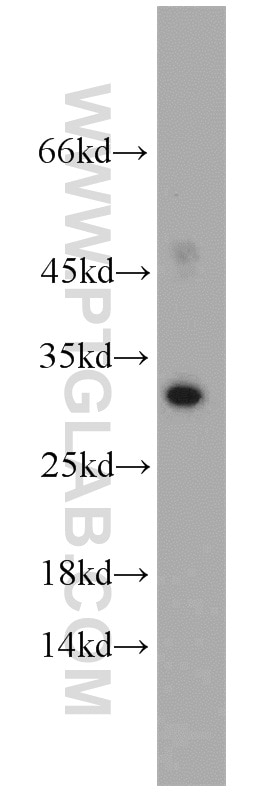 Western Blot (WB) analysis of human heart tissue using Mast Cell Chymase Polyclonal antibody (18189-1-AP)