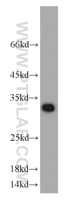 Western Blot (WB) analysis of human placenta tissue using Mast Cell Chymase Polyclonal antibody (18189-1-AP)