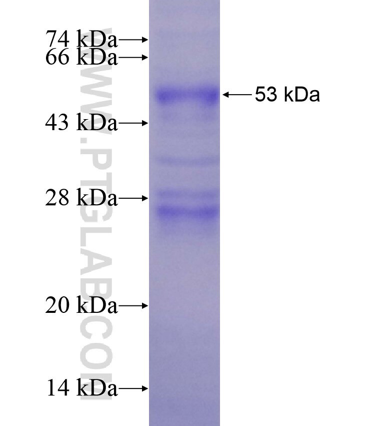 CMA1 fusion protein Ag12909 SDS-PAGE