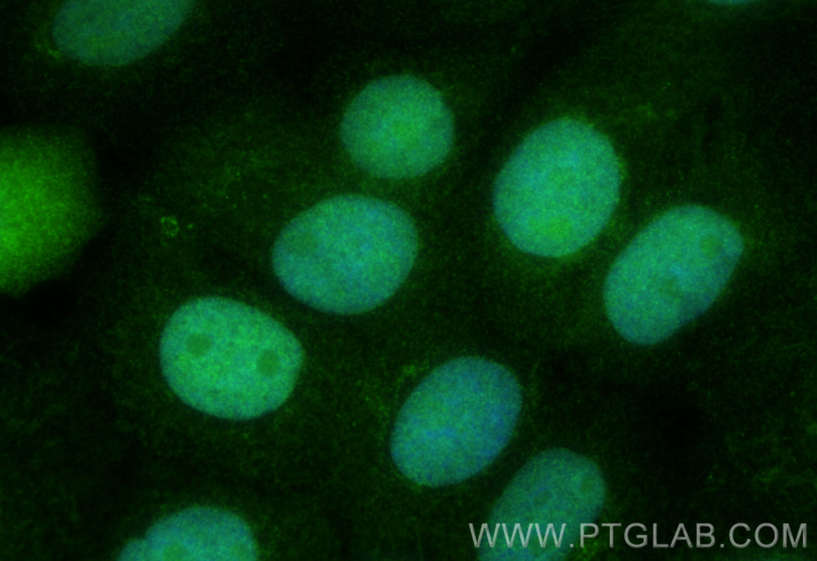 Immunofluorescence (IF) / fluorescent staining of A431 cells using CMAS Polyclonal antibody (13006-1-AP)