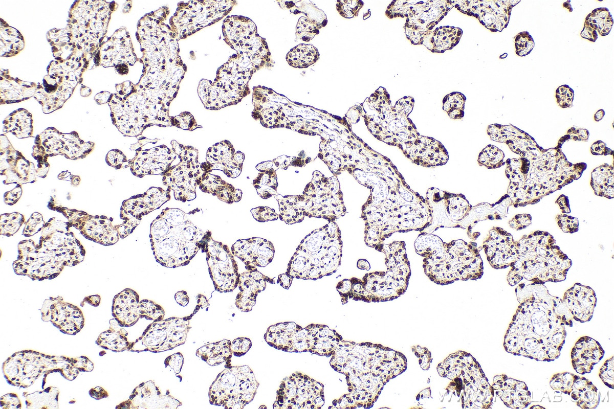 Immunohistochemistry (IHC) staining of human placenta tissue using CMAS Polyclonal antibody (13006-1-AP)