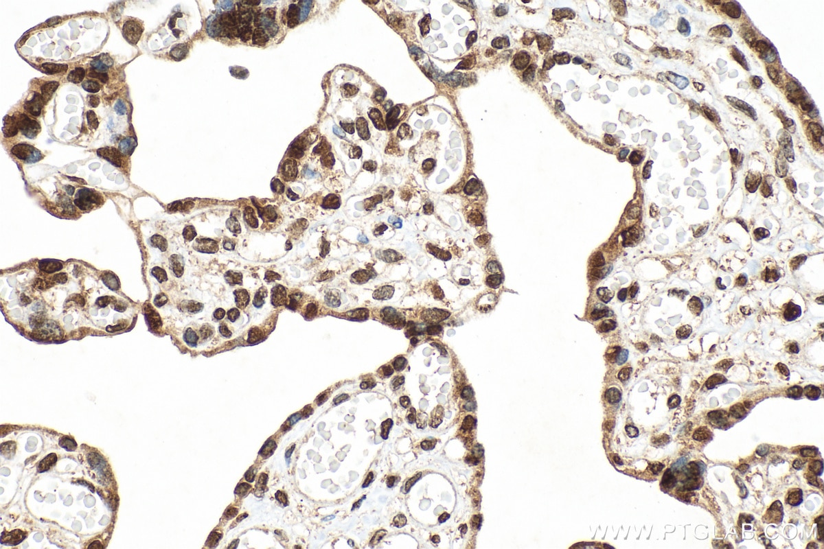 Immunohistochemistry (IHC) staining of human placenta tissue using CMAS Polyclonal antibody (13006-1-AP)