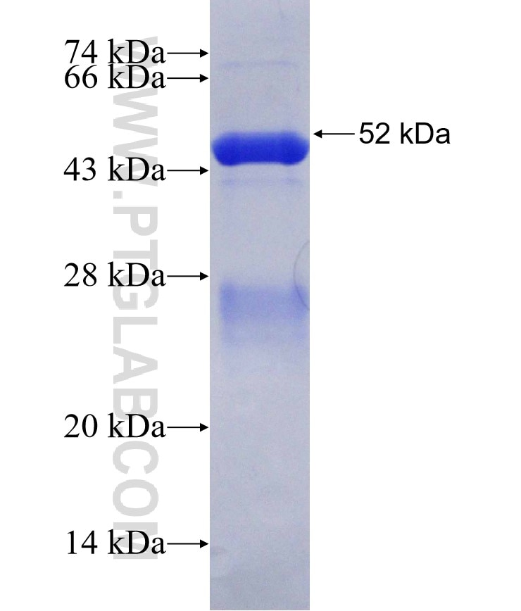 CMAS fusion protein Ag3686 SDS-PAGE