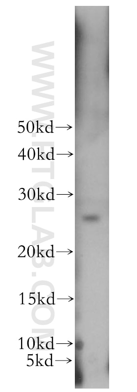 Western Blot (WB) analysis of mouse liver tissue using CMBL Polyclonal antibody (17409-1-AP)