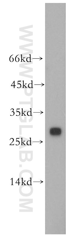 Western Blot (WB) analysis of HeLa cells using CMBL Polyclonal antibody (17409-1-AP)
