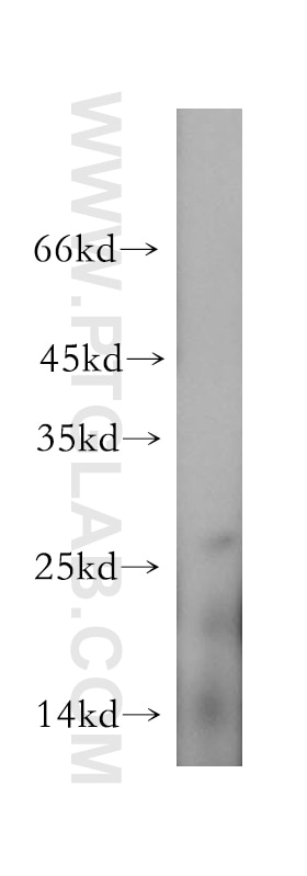 Western Blot (WB) analysis of mouse skeletal muscle tissue using CMBL Polyclonal antibody (17409-1-AP)
