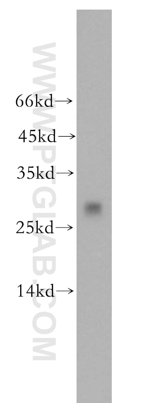 Western Blot (WB) analysis of mouse kidney tissue using CMBL Polyclonal antibody (17409-1-AP)