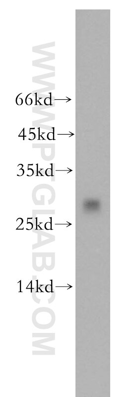 WB analysis of mouse kidney using 17409-1-AP