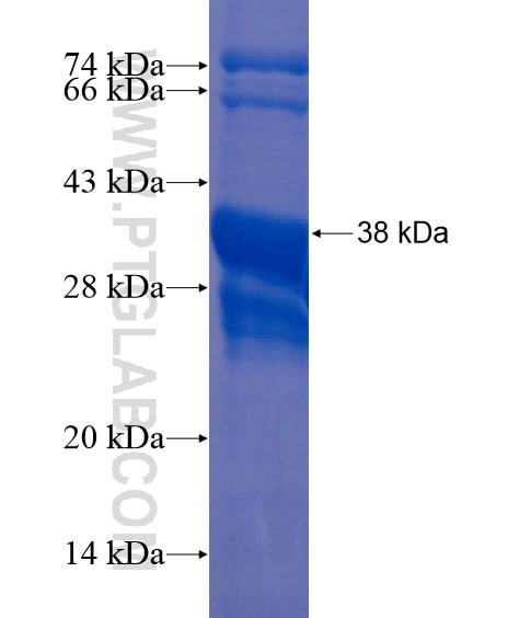 CMC1 fusion protein Ag21224 SDS-PAGE