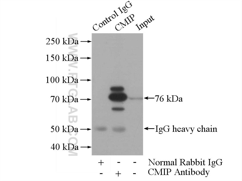 Immunoprecipitation (IP) experiment of Raji cells using CMIP Polyclonal antibody (12851-1-AP)