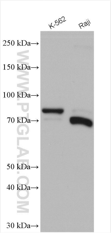 Western Blot (WB) analysis of various lysates using CMIP Polyclonal antibody (12851-1-AP)