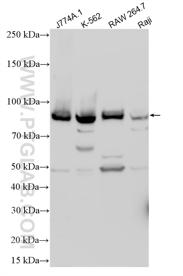 Western Blot (WB) analysis of various lysates using CMIP Polyclonal antibody (12851-1-AP)