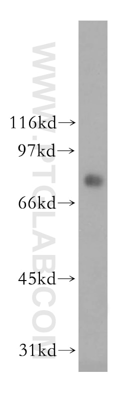 Western Blot (WB) analysis of Raji cells using CMIP Polyclonal antibody (12851-1-AP)