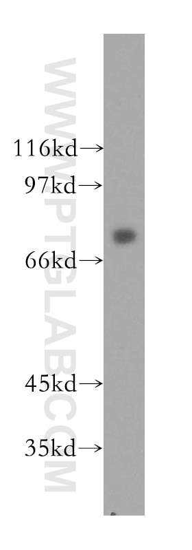 Western Blot (WB) analysis of Raji cells using CMIP Polyclonal antibody (12851-1-AP)