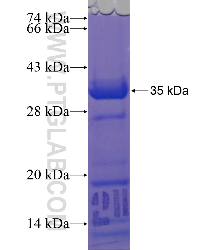 CMIP fusion protein Ag17875 SDS-PAGE