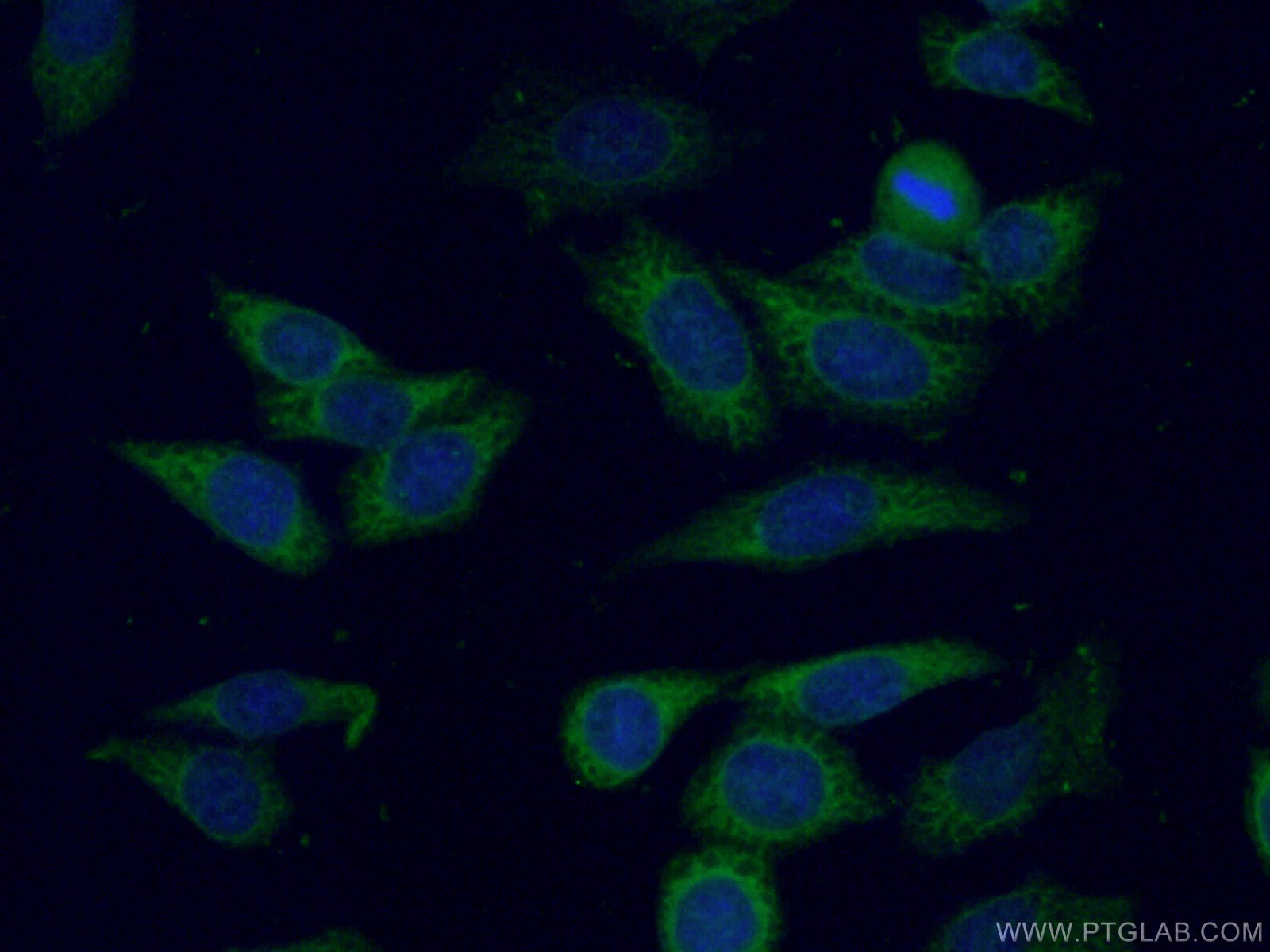 Immunofluorescence (IF) / fluorescent staining of HeLa cells using UMP/CMP kinase Polyclonal antibody (11360-1-AP)