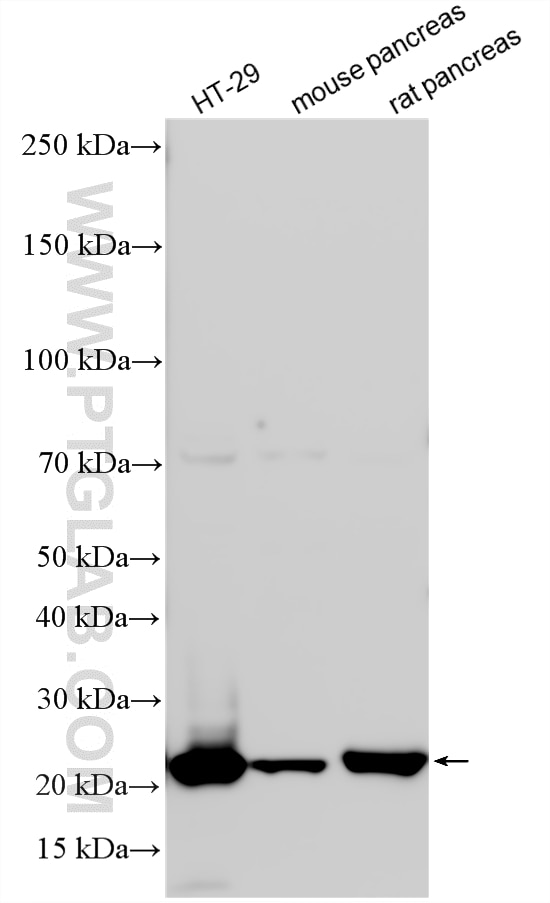 WB analysis using 11360-1-AP Western Blot (WB) analysis of various lysates using UMP/CMP kinase Polyclonal antibody (11360-1-AP)