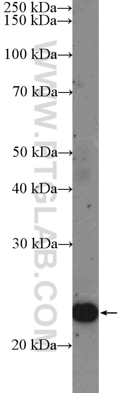 Western Blot (WB) analysis of mouse pancreas tissue using UMP/CMP kinase Polyclonal antibody (11360-1-AP)