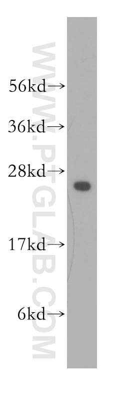 Western Blot (WB) analysis of human skeletal muscle tissue using UMP/CMP kinase Polyclonal antibody (11360-1-AP)