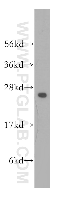 WB analysis of human skeletal muscle using 11360-1-AP