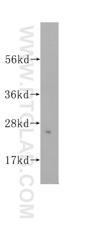Western Blot (WB) analysis of human skeletal muscle tissue using UMP/CMP kinase Polyclonal antibody (11360-1-AP)