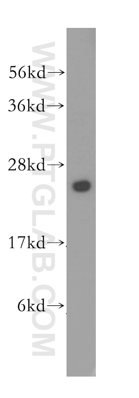 WB analysis of human pancreas using 11360-1-AP