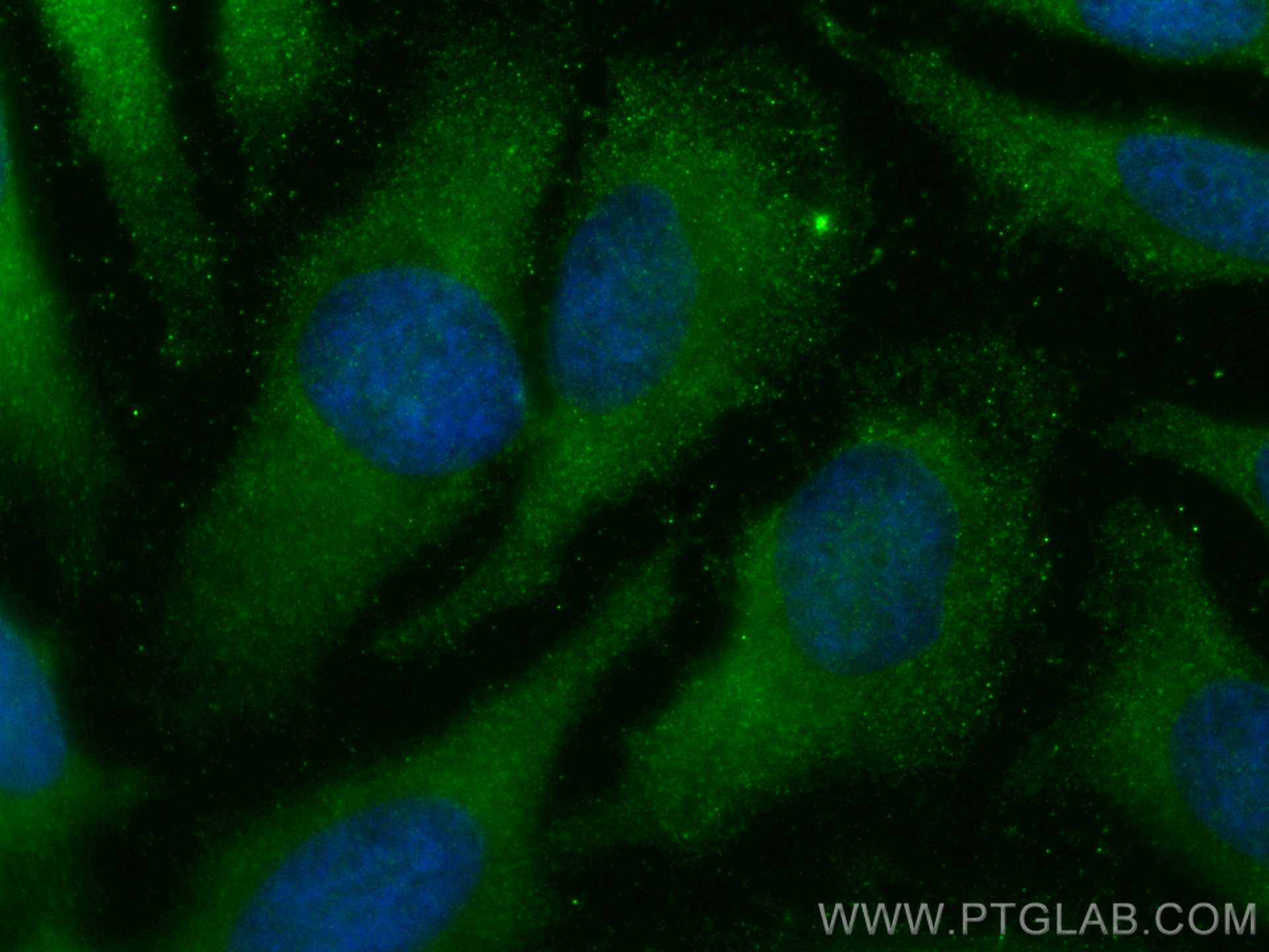 Immunofluorescence (IF) / fluorescent staining of HeLa cells using CMPK1 Monoclonal antibody (67519-1-Ig)