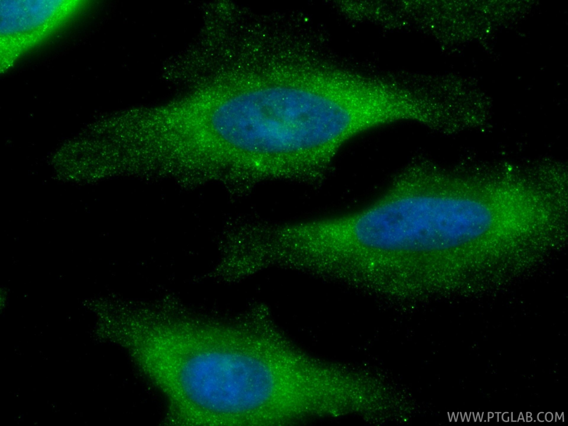 IF Staining of HeLa using 67519-1-Ig Immunofluorescence (IF) / fluorescent staining of HeLa cells using UMP/CMP kinase Monoclonal antibody (67519-1-Ig)