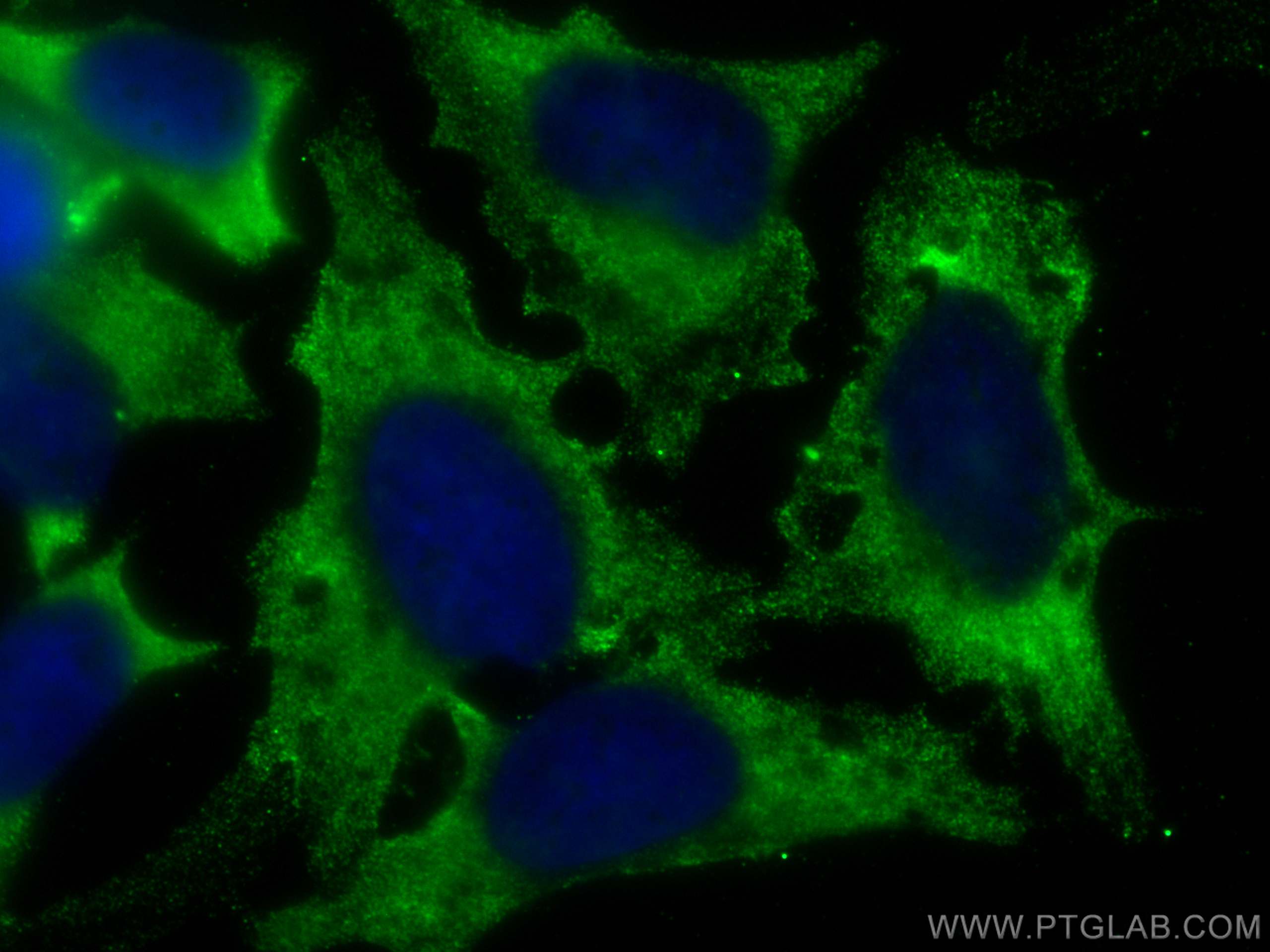 Immunofluorescence (IF) / fluorescent staining of HeLa cells using CoraLite® Plus 488-conjugated CMPK1 Monoclonal ant (CL488-67519)