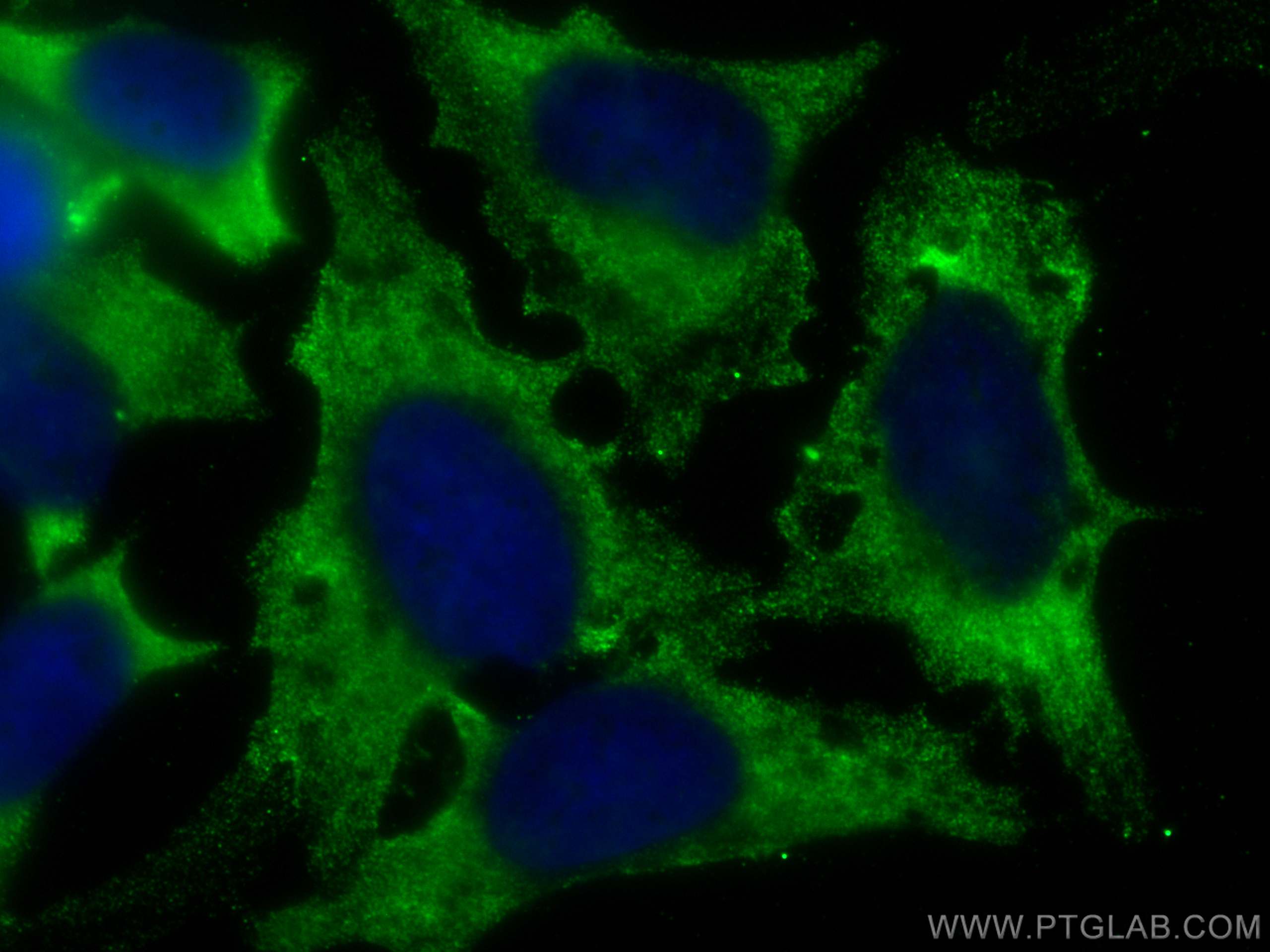 IF Staining of HeLa using CL488-67519