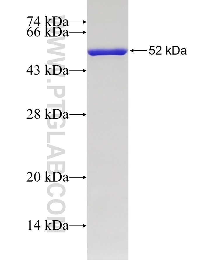 CMPK1 fusion protein Ag1920 SDS-PAGE