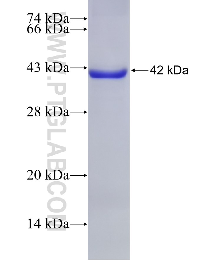 CMPK2 fusion protein Ag22885 SDS-PAGE