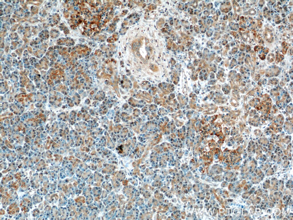 Immunohistochemistry (IHC) staining of human pancreas tissue using CMTM8 Polyclonal antibody (15039-1-AP)