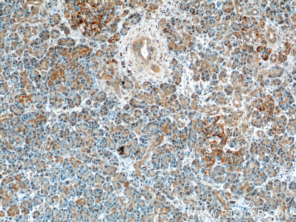 IHC staining of human pancreas using 15039-1-AP