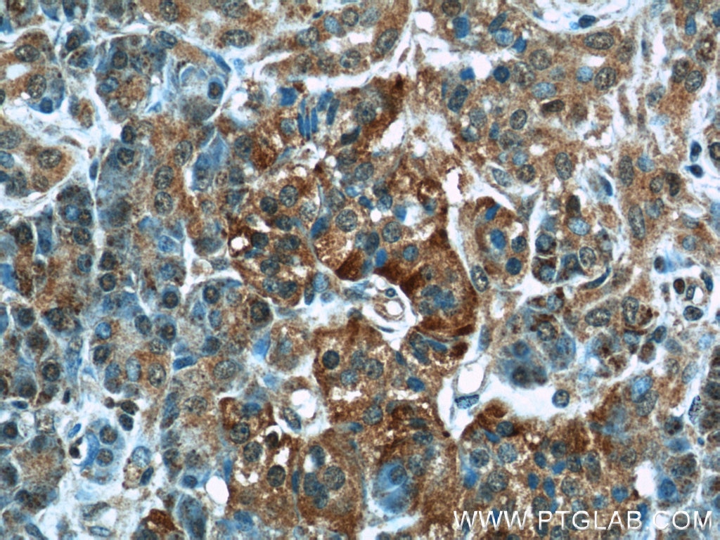 Immunohistochemistry (IHC) staining of human pancreas tissue using CMTM8 Polyclonal antibody (15039-1-AP)