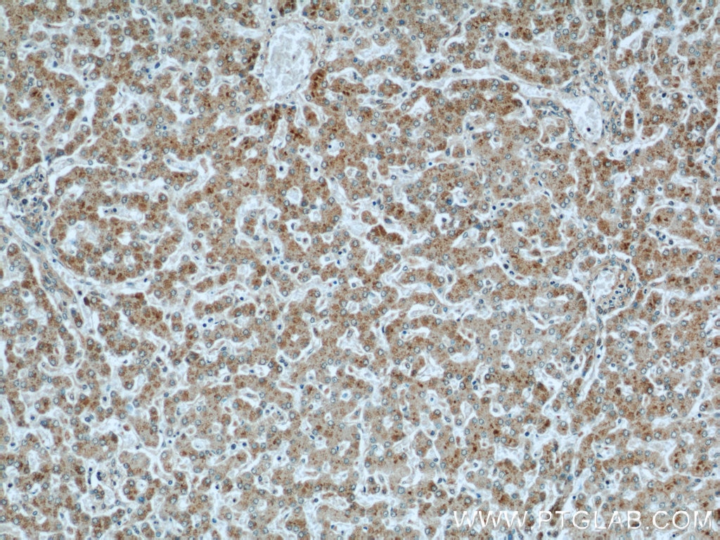 Immunohistochemistry (IHC) staining of human liver tissue using CMTM8 Polyclonal antibody (15039-1-AP)