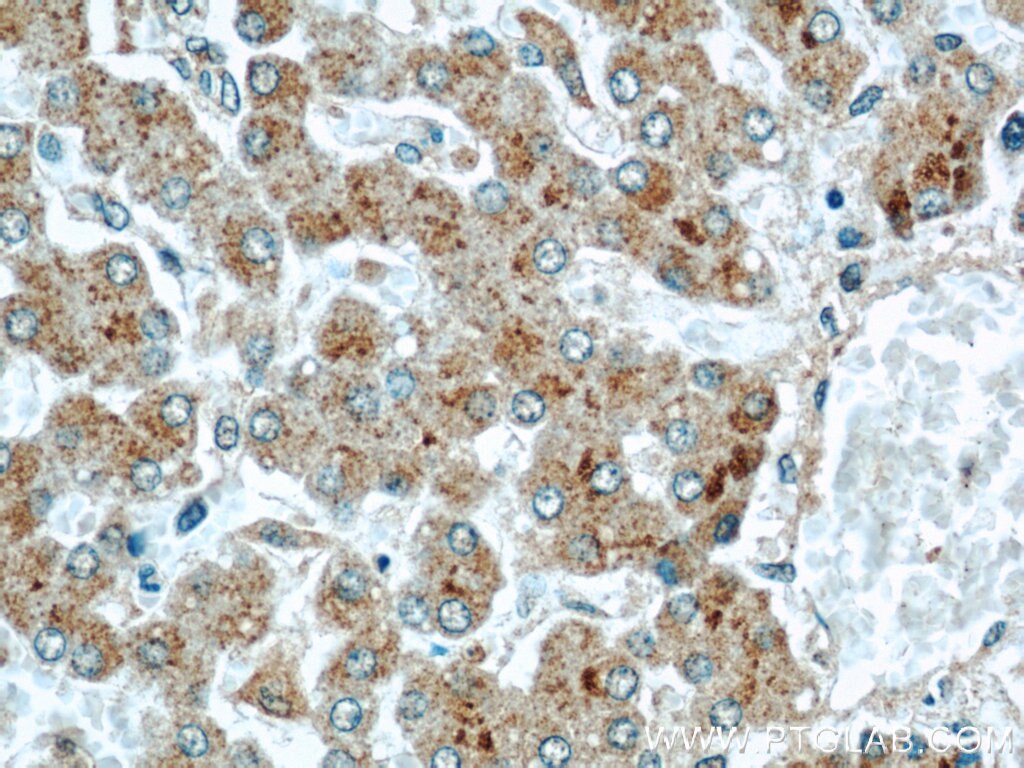 Immunohistochemistry (IHC) staining of human liver tissue using CMTM8 Polyclonal antibody (15039-1-AP)