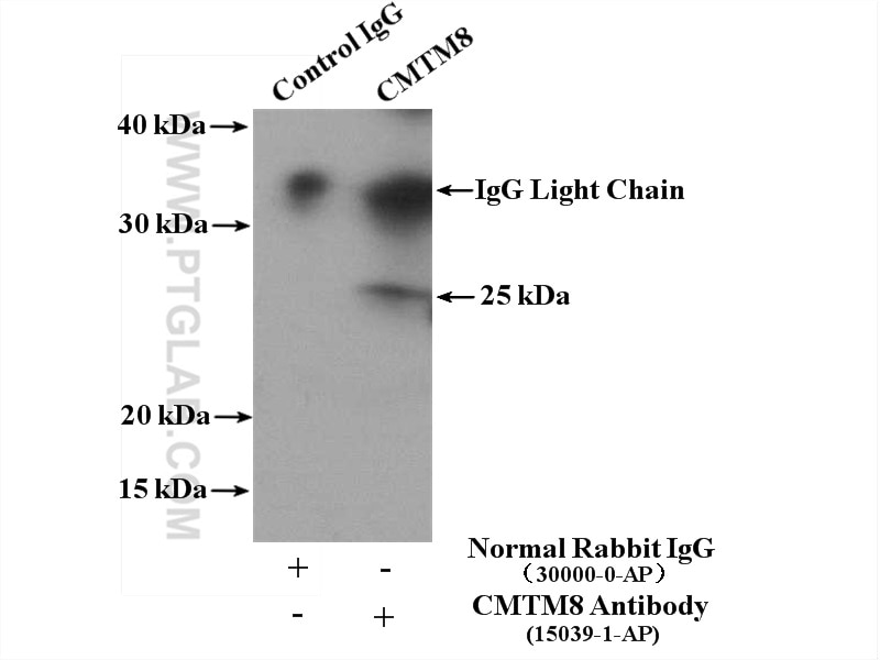 Immunoprecipitation (IP) experiment of mouse liver tissue using CMTM8 Polyclonal antibody (15039-1-AP)