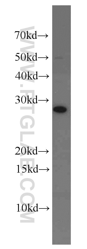 Western Blot (WB) analysis of mouse liver tissue using CMTM8 Polyclonal antibody (15039-1-AP)