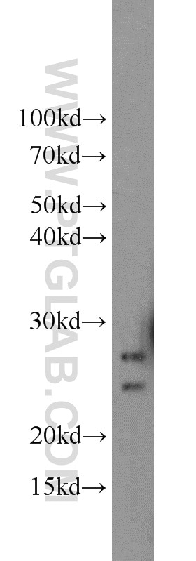 Western Blot (WB) analysis of mouse pancreas tissue using CMTM8 Polyclonal antibody (15039-1-AP)