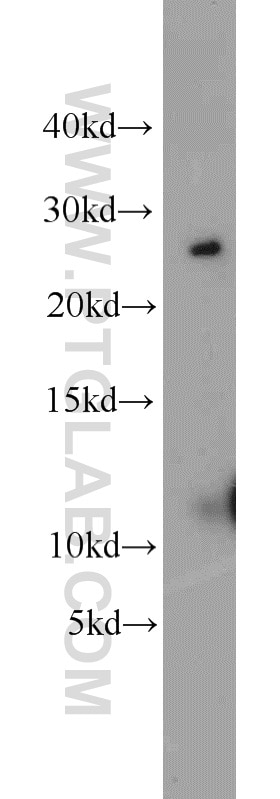 Western Blot (WB) analysis of mouse liver tissue using CMTM8 Polyclonal antibody (15039-1-AP)
