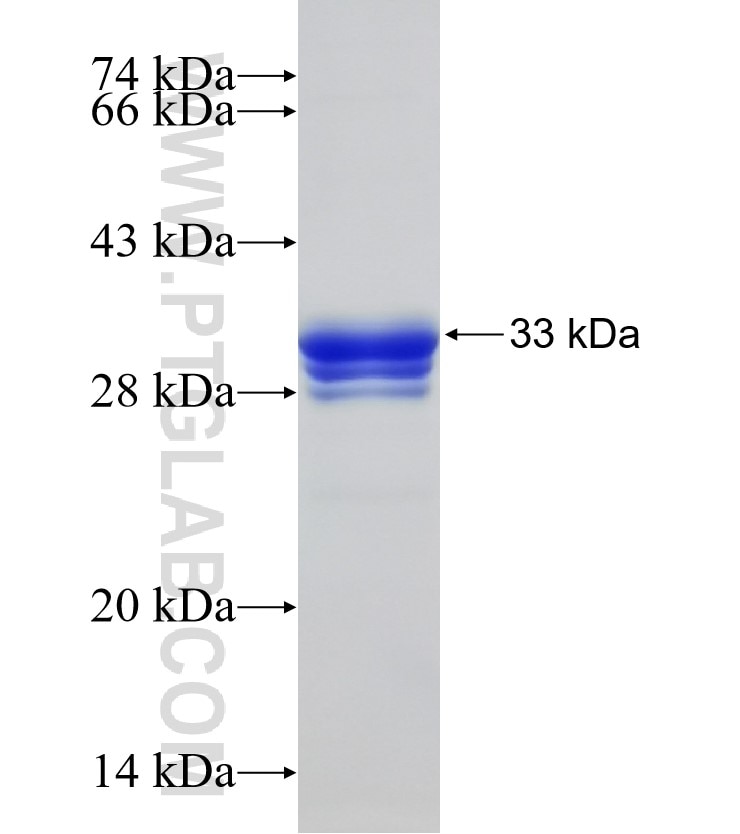 CMTM8 fusion protein Ag6776 SDS-PAGE