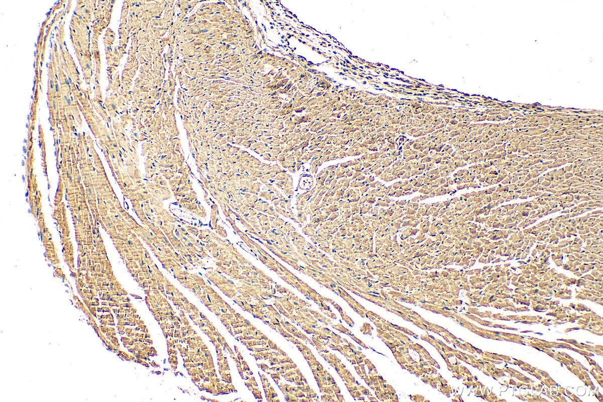 Immunohistochemistry (IHC) staining of mouse heart tissue using CMYA5 Polyclonal antibody (31176-1-AP)