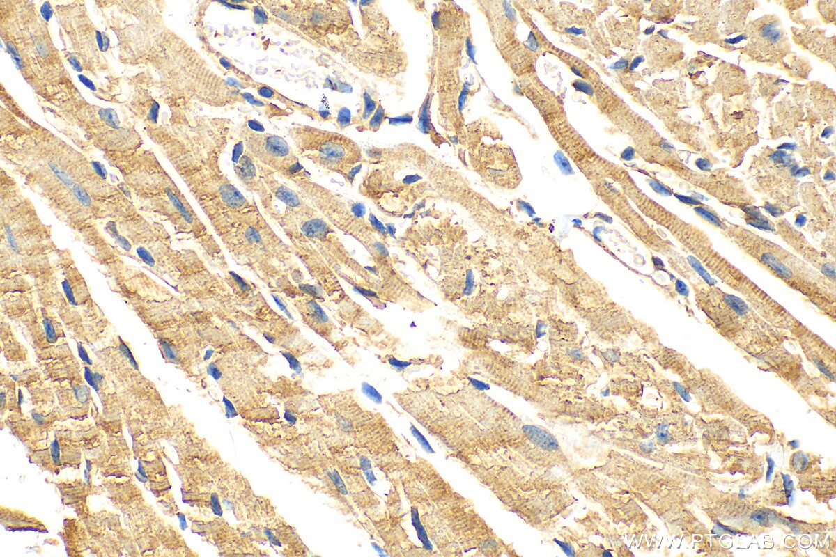 Immunohistochemistry (IHC) staining of mouse heart tissue using CMYA5 Polyclonal antibody (31176-1-AP)
