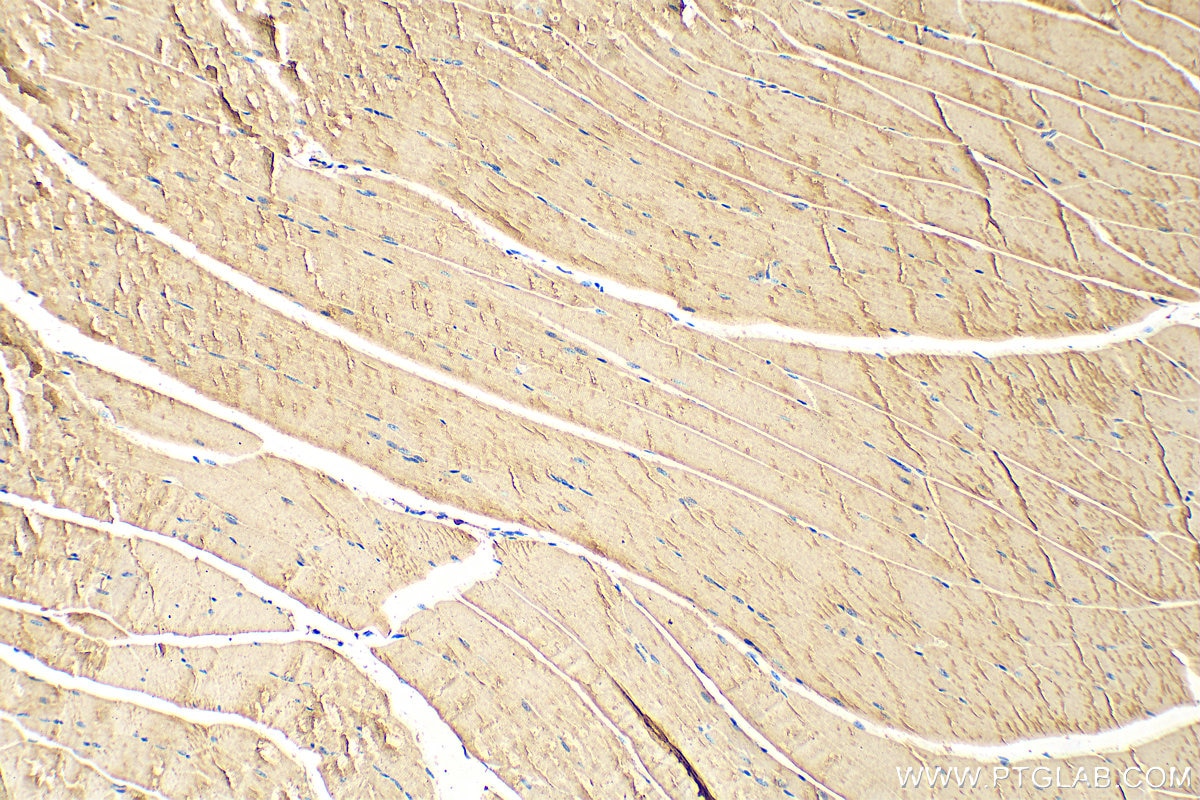 Immunohistochemistry (IHC) staining of mouse skeletal muscle tissue using CMYA5 Polyclonal antibody (31176-1-AP)
