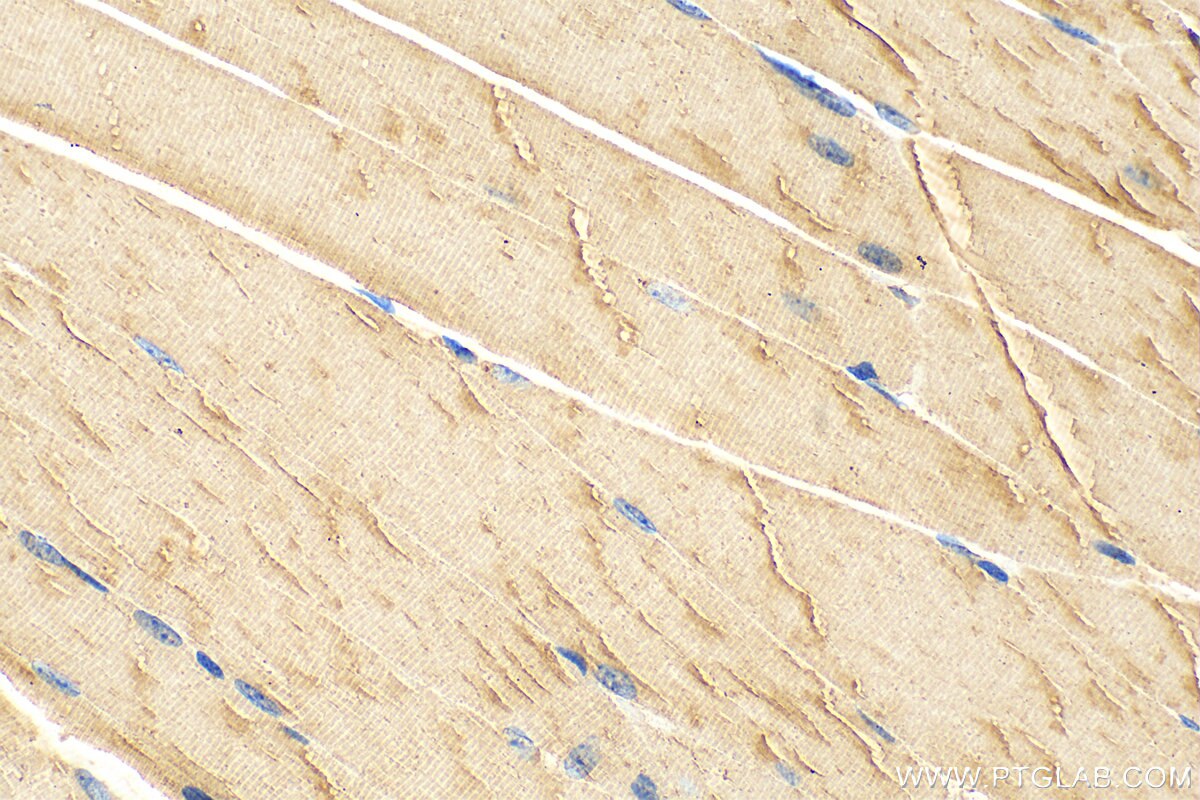 Immunohistochemistry (IHC) staining of mouse skeletal muscle tissue using CMYA5 Polyclonal antibody (31176-1-AP)