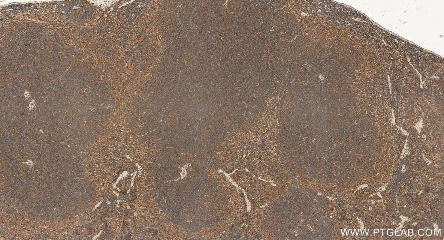Immunohistochemistry (IHC) staining of mouse spleen tissue using CNBP Polyclonal antibody (14717-1-AP)
