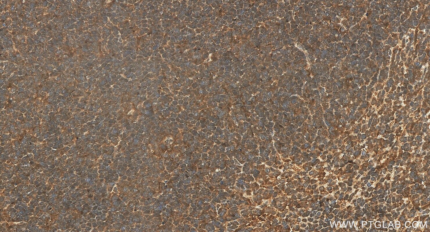Immunohistochemistry (IHC) staining of mouse spleen tissue using CNBP Polyclonal antibody (14717-1-AP)